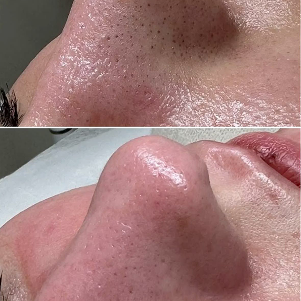 Aqua Beauty Masaj